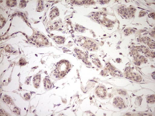 LPIN1 / Lipin 1 Antibody (aa1-274, clone OTI4C11)