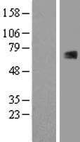 RUNX1T1 / ETO Protein (Over-Expression Lysate Myc-DDK (Flag))