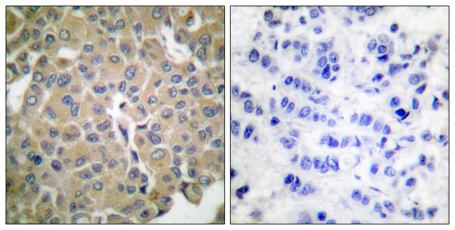 MLANA / Melan-A Antibody (aa41-90)