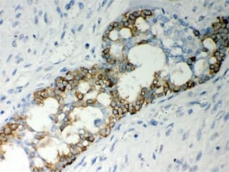 CASP7 / Caspase 7 Antibody