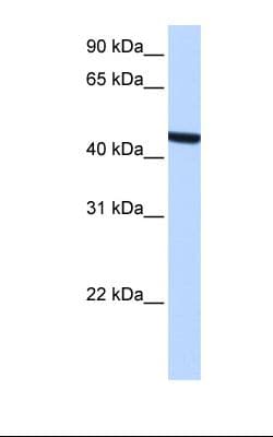 ZCCHC3 Antibody (aa181-230)