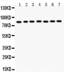 MAD1L1 / MAD1 Antibody (aa362-632)