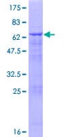 Human VPS11 Protein (Recombinant GST)