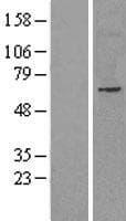 NET1 / ARHGEF8 Protein (Over-Expression Lysate Myc-DDK (Flag))