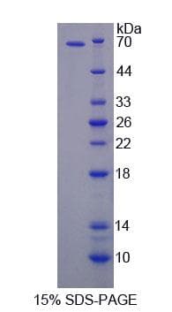 Human FE65L1 / APBB2 Protein (Recombinant His-GST, N-terminus)