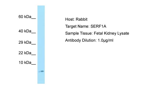 Polyclonal Rabbit anti-Human SERF1A / SERF1 Antibody (C-Terminus, WB)