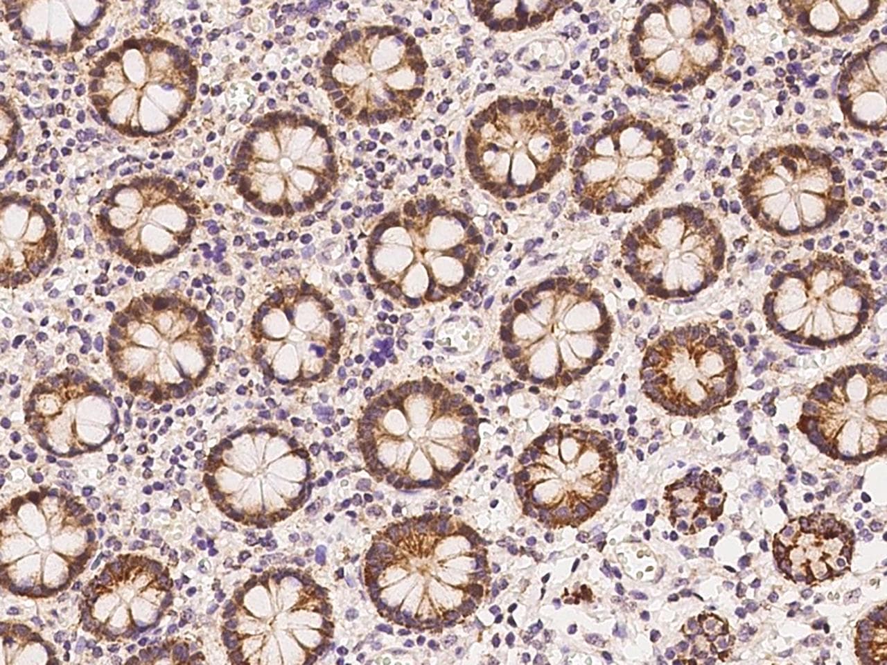 HMGCS1 / HMG-CoA Synthase 1 Antibody