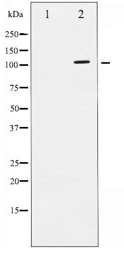 ATPase Antibody (phospho-Ser16)