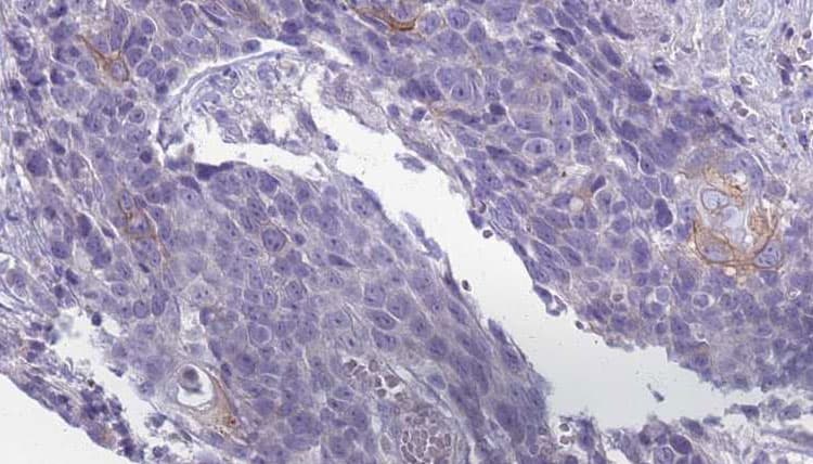 KCNJ13 / KIR7.1 Antibody