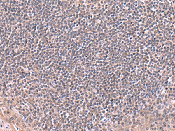 Polyclonal Rabbit anti-Human RIC8A Antibody (IHC)