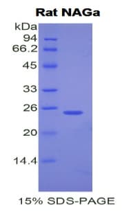 Rat NAGA Protein (Recombinant His)