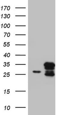 Monoclonal Mouse anti-Human CHCHD3 Antibody (clone OTI2A6, aa2-227, IHC, WB)