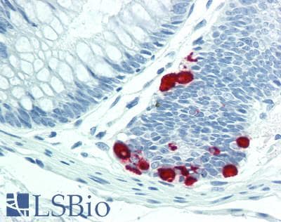 LECT1 / Chondromodulin-I Antibody (aa134-334)