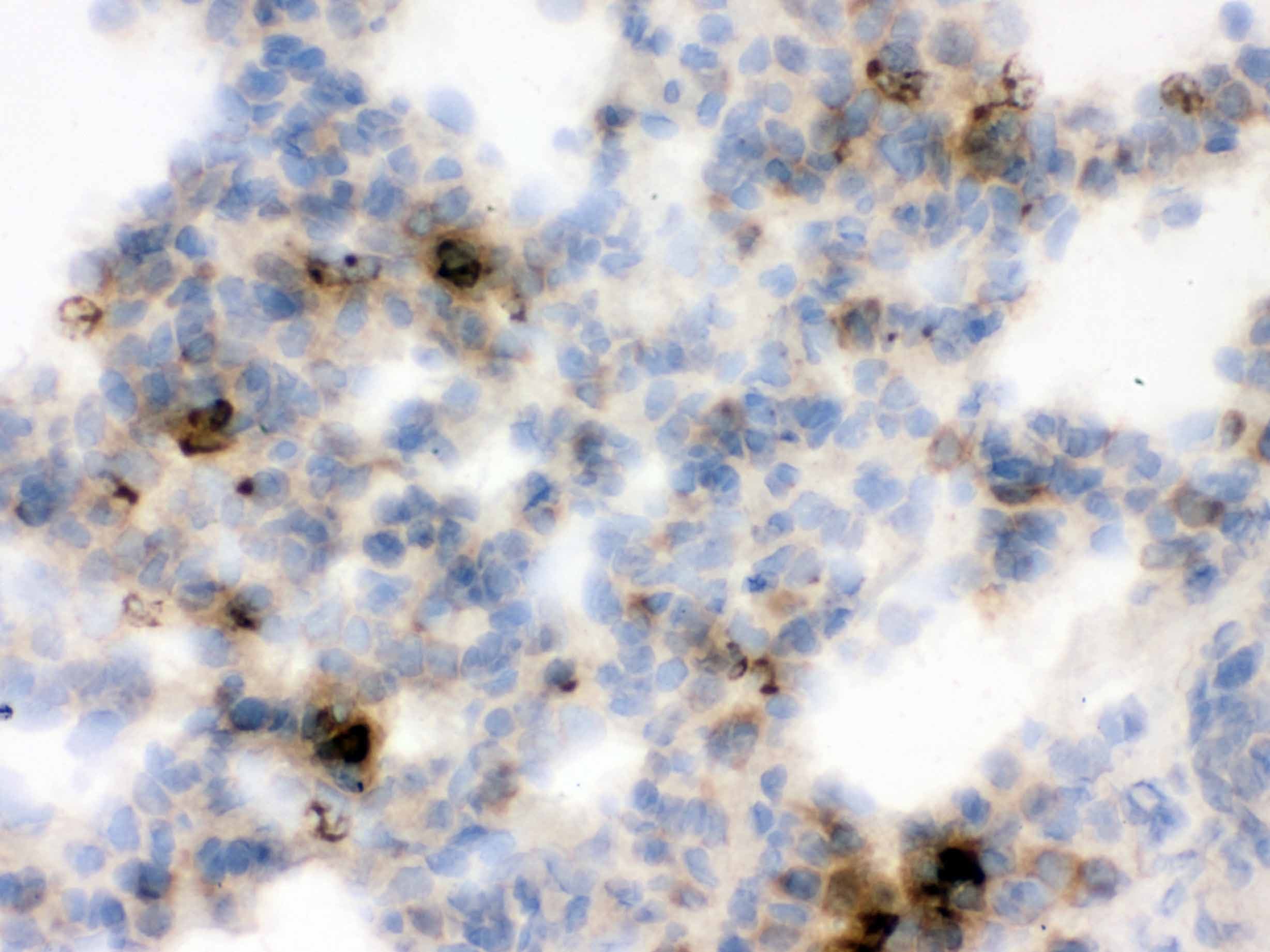 Polyclonal Rabbit anti-Rat LCN2 / Lipocalin 2 / NGAL Antibody (aa21-198, IHC, WB)