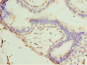 STX11 / Syntaxin 11 Antibody (aa1-287)