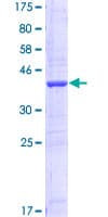 Human BABP / AKR1C2 Protein (Recombinant GST, N-terminus)