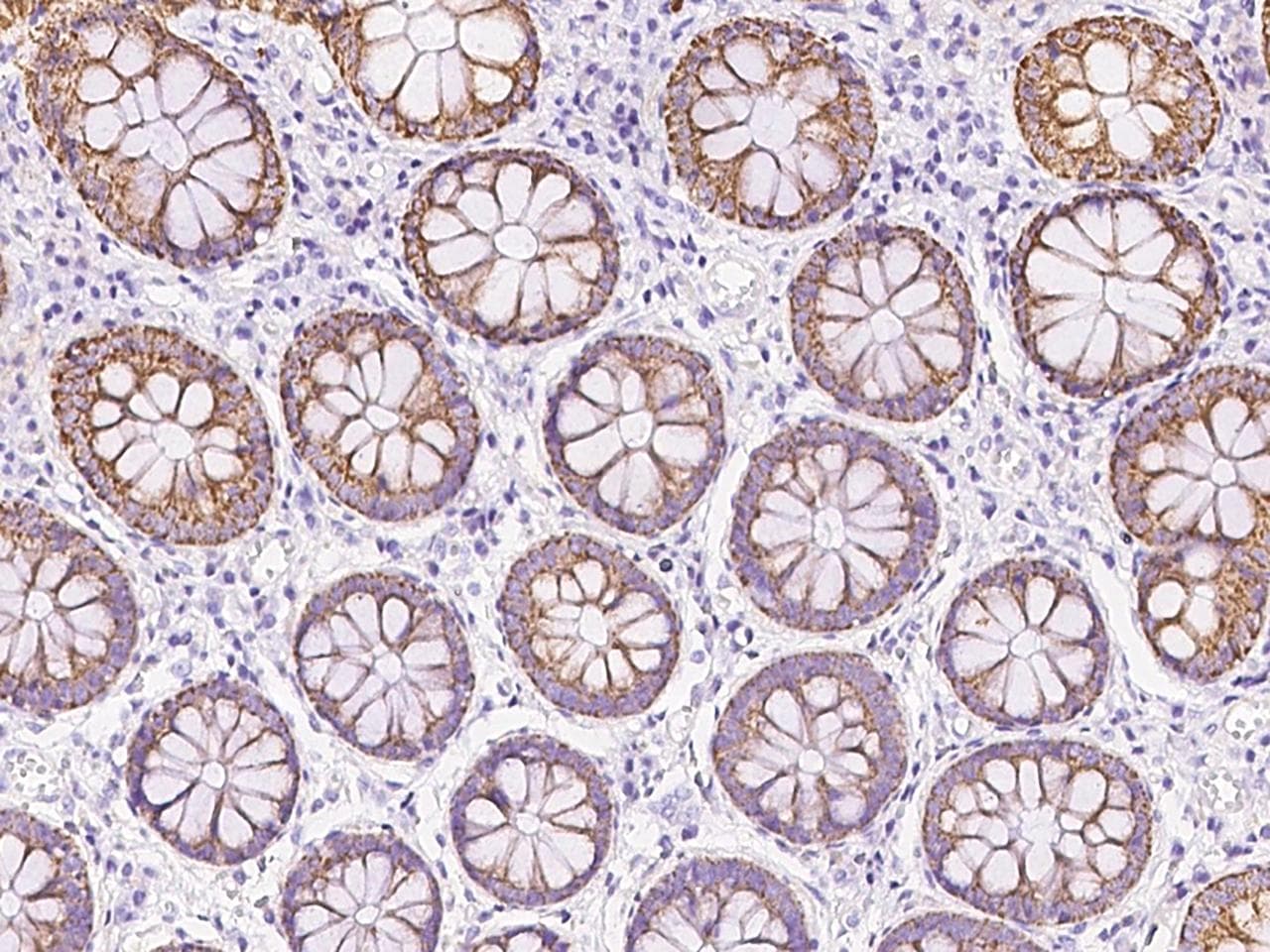 Rhodanese / TST Antibody