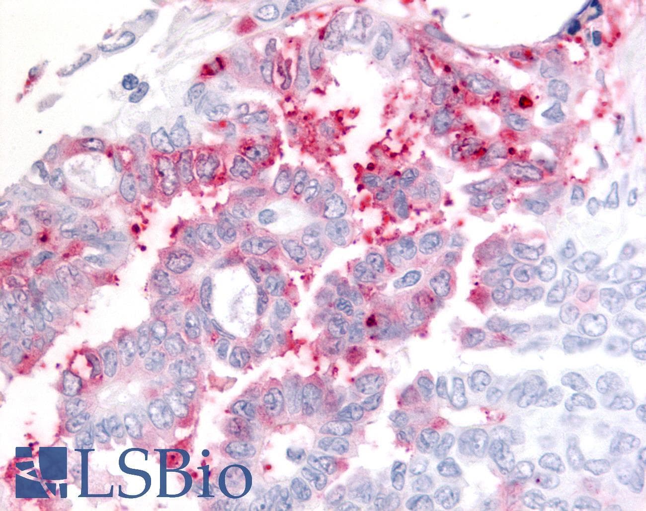 PathPlus™ Polyclonal Rabbit anti-Human ADAMTS5 Antibody (C-Terminus, IHC)