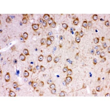 Polyclonal Rabbit anti-Human KCNIP2 / KCHIP2 Antibody (aa78-112, IHC, WB)