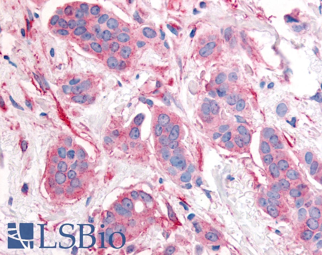 IHC-plus™ Polyclonal Rabbit anti-Human ERBB2 / HER2 Antibody (Cytoplasmic Domain, IHC)