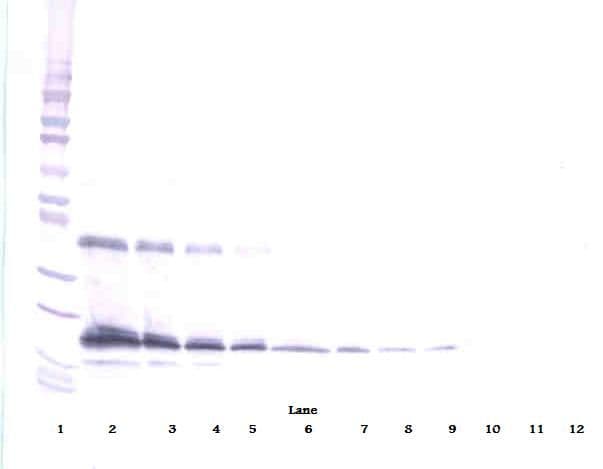 THPO / TPO / Thrombopoietin Antibody