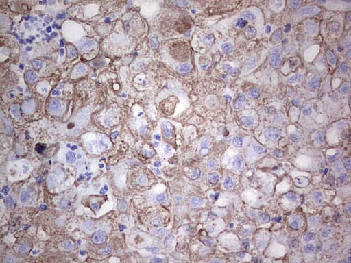 Acidic Cytokeratin Antibody (clone 8A3)