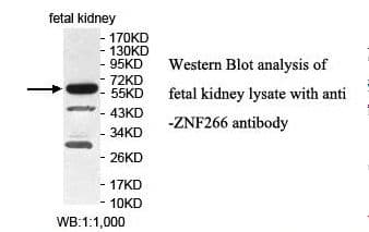 Polyclonal Rabbit anti-Human ZNF266 Antibody (aa22-254, IHC, WB)