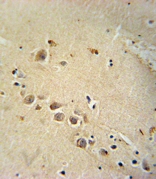 RASGRP1 / RASGRP Antibody (aa495-521)