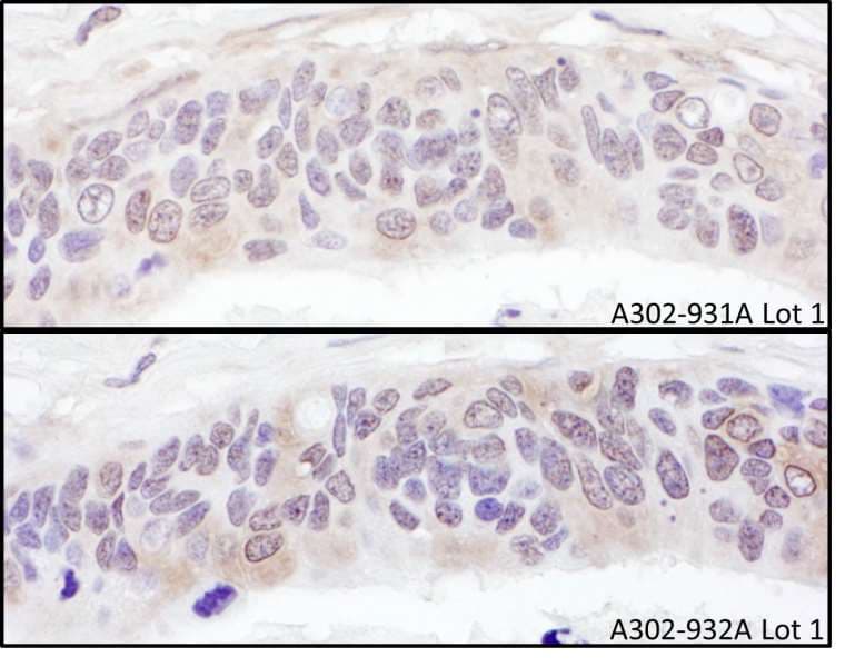 UBXN6 / UBXD1 Antibody (aa250-300)