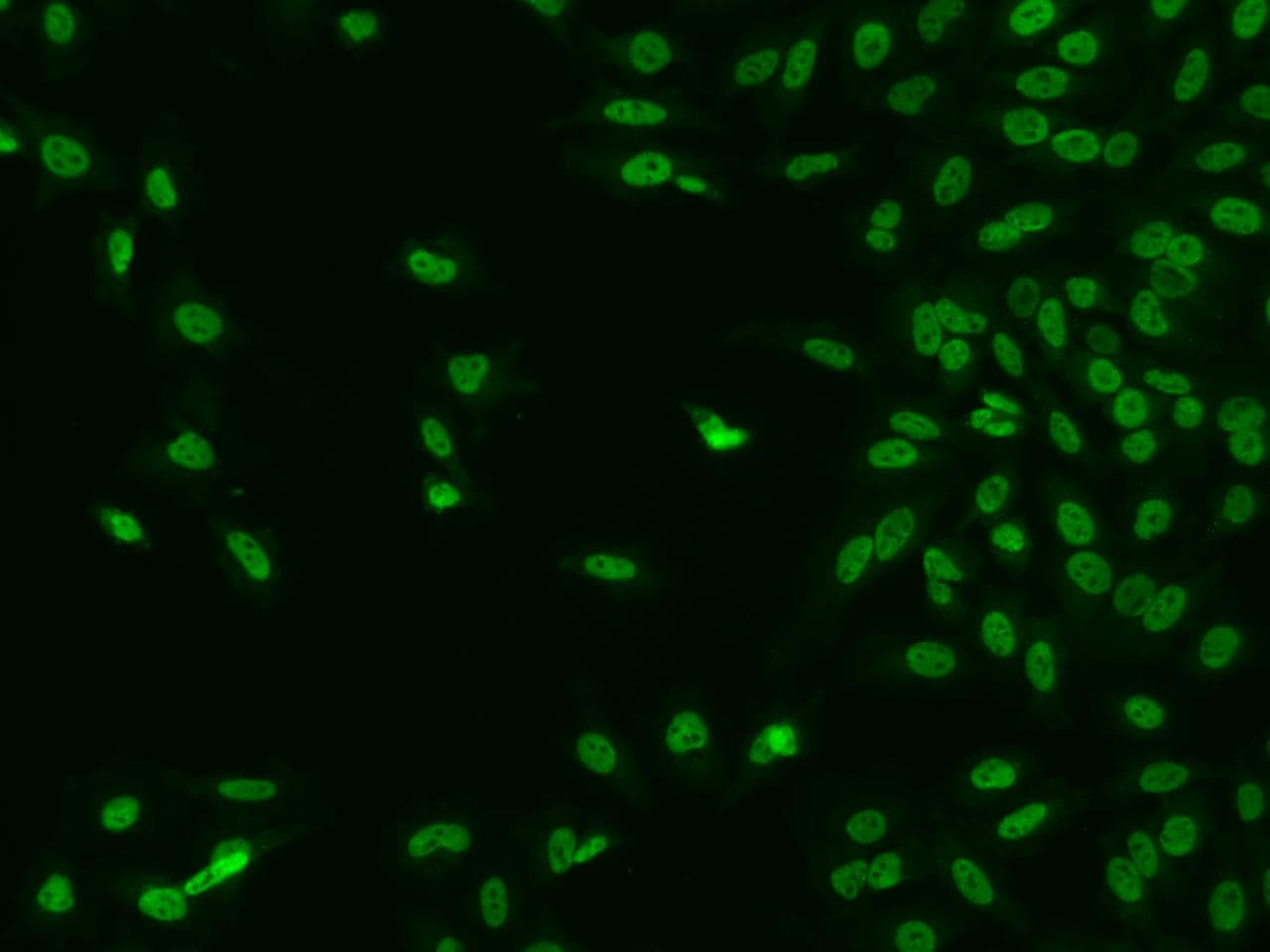 CTDSP2 Antibody