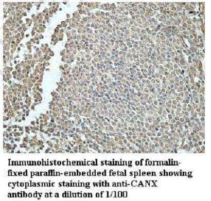 CANX / Calnexin Antibody (C-Terminus)