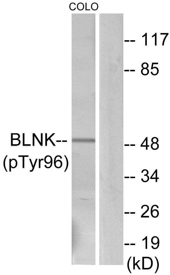 BLNK Antibody (phospho-Tyr96)