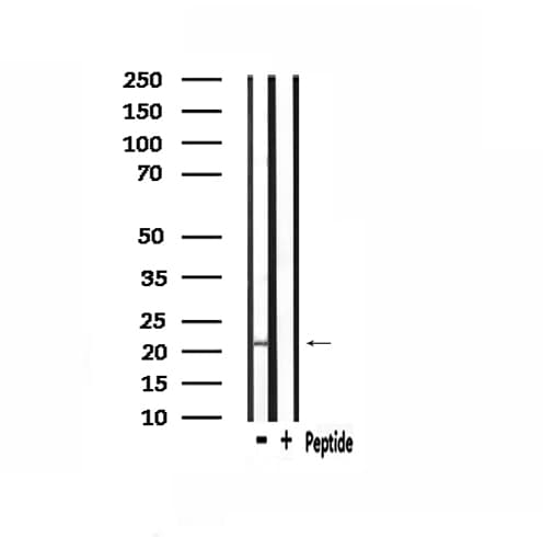 PMP22 Antibody