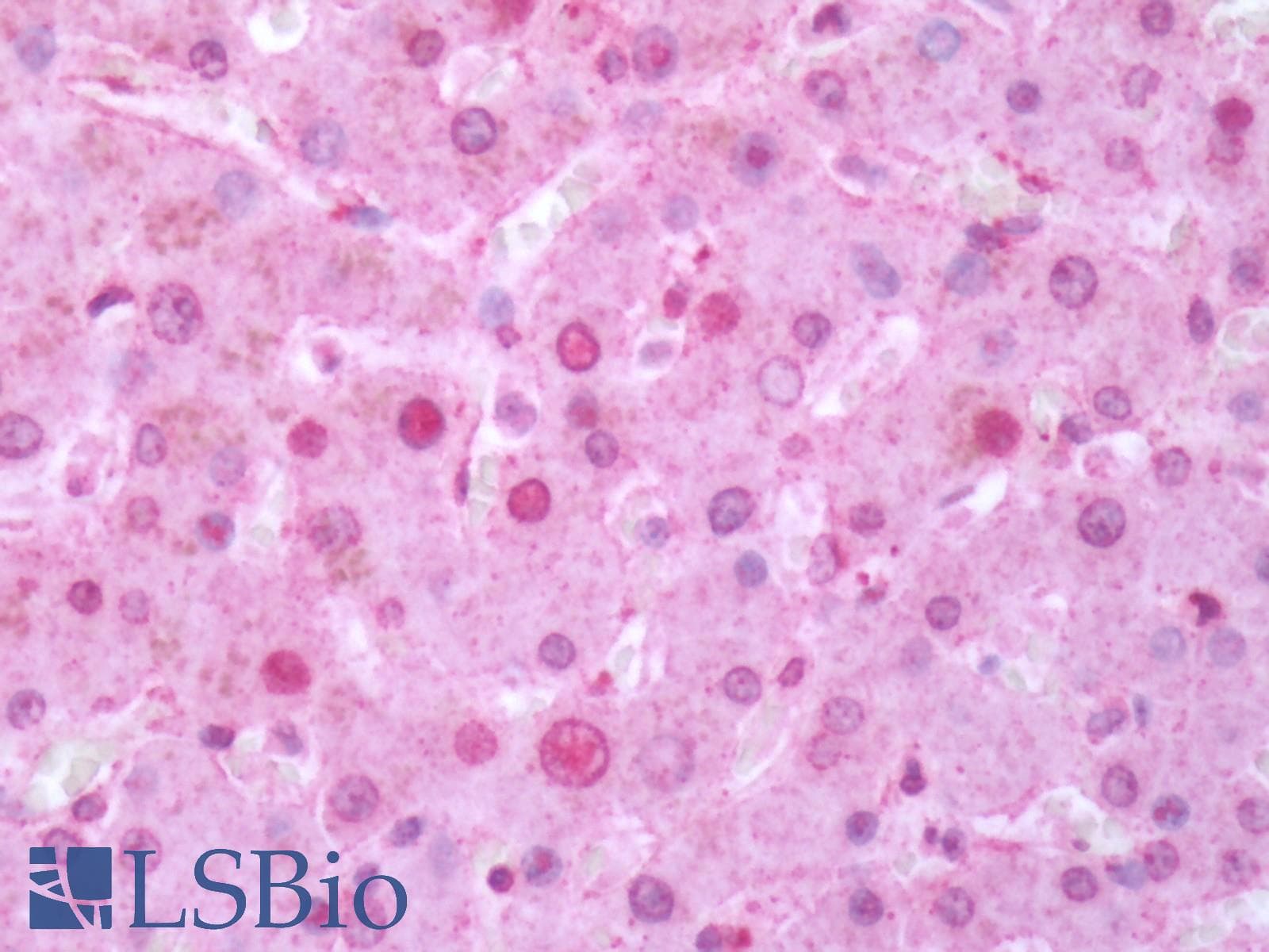 PathPlus™ Polyclonal Rabbit anti-Human RORC / ROR Gamma Antibody (Ligand-binding Domain, IHC)
