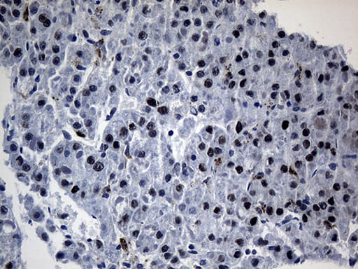 OIP5 Antibody (clone OTI7H9)