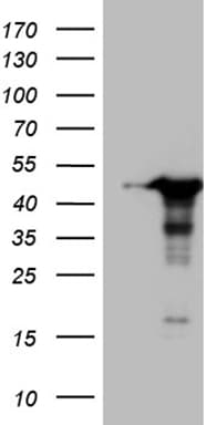 Monoclonal Mouse anti-Human WDR92 Antibody (clone OTI5H5, WB)