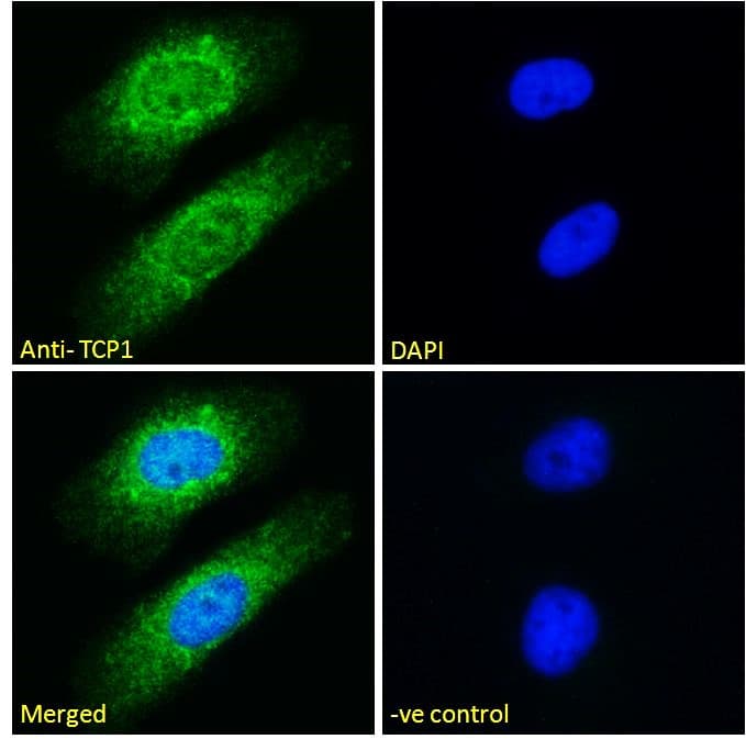 IHC-plus™ TCP1 Antibody (aa544-556)