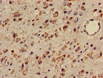 Polyclonal Rabbit anti-Human TTC27 Antibody (IHC, WB)