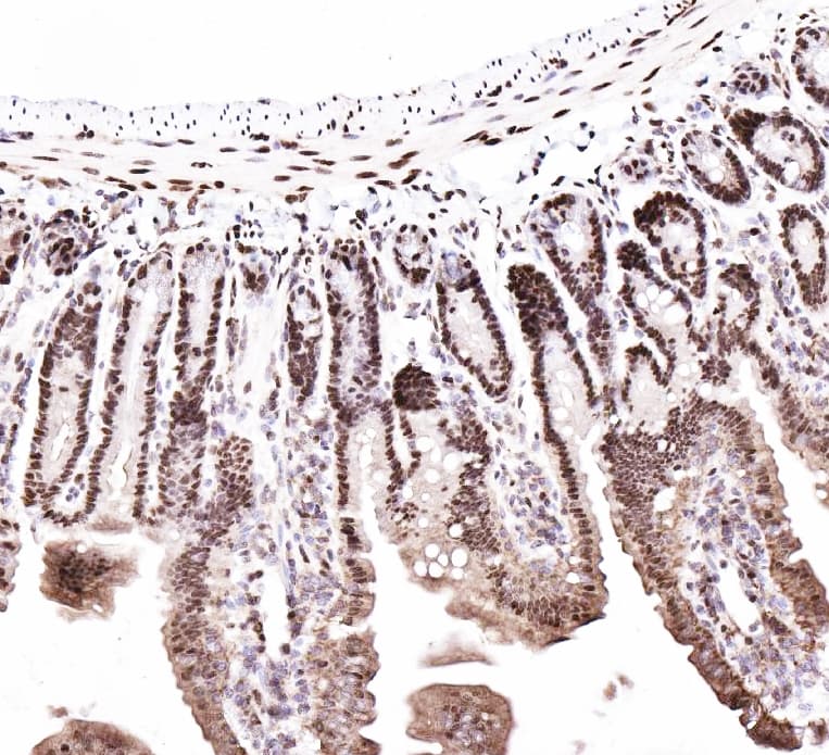 Polyclonal Rabbit anti-Human CTBP2 Antibody (aa429-445, IHC, WB)