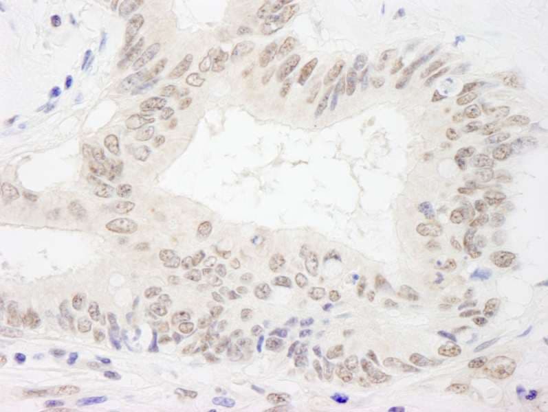 Polyclonal Rabbit anti-Human XPA Antibody (aa1-50, IHC)