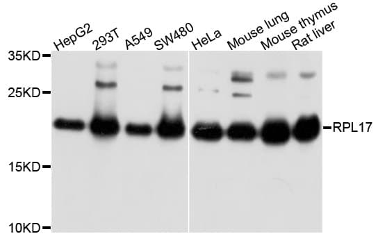 Polyclonal Rabbit anti-Human RPL17 / Ribosomal Protein L17 Antibody (WB)