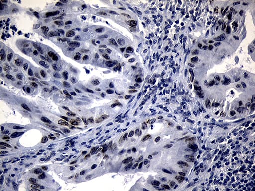 Monoclonal Mouse anti-Human NSD3 / WHSC1L1 Antibody (clone OTI3G3, Carrier-free, aa427-566, IHC)