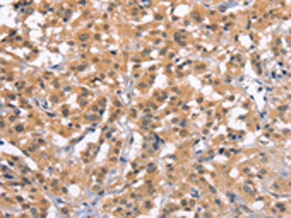 ZFYVE19 Antibody