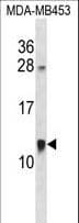 Polyclonal Rabbit anti-Human ACBD7 Antibody (aa60-88, WB)