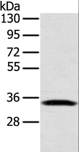 Polyclonal Rabbit anti-Human STX11 / Syntaxin 11 Antibody (IHC, WB)