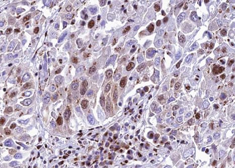 Polyclonal Rabbit anti-Human METTL3 Antibody (IHC, WB)