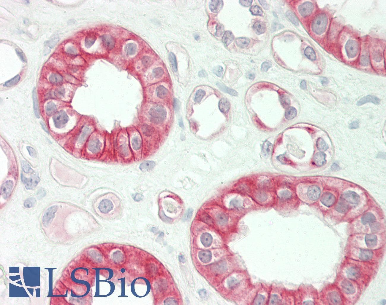 Polyclonal Rabbit anti-Rat FGF3 Antibody (aa160-209, IHC, WB)