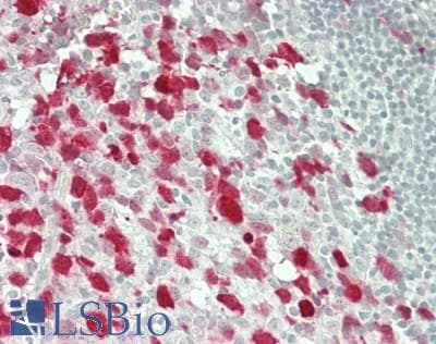IHC-plus™ KPNA2 / Importin Alpha 1 Antibody (aa475-C-term)