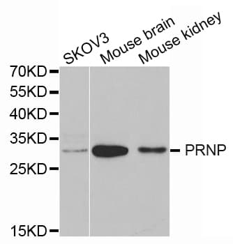 Polyclonal Rabbit anti-Human PRNP / PrP / Prion Antibody (IHC, WB)