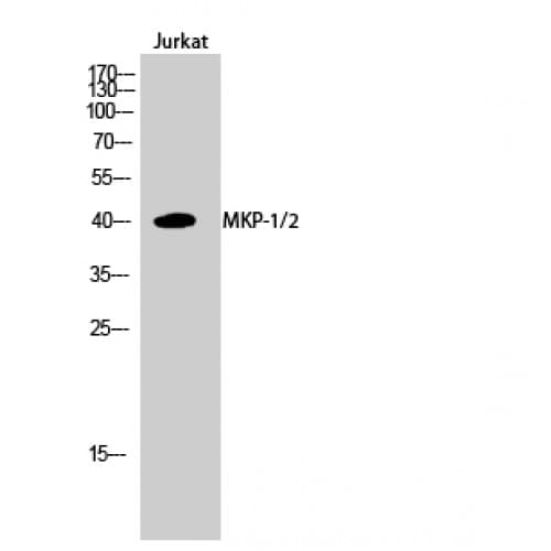 Polyclonal Rabbit anti-Human DUSP1 + DUSP4 Antibody (230-310 aa, IHC, WB)